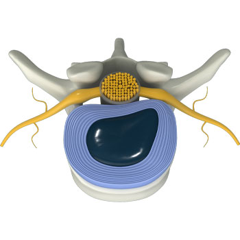 spinal decompression stretches the spine