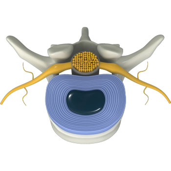 During the repair process, inflammation and pain decreases